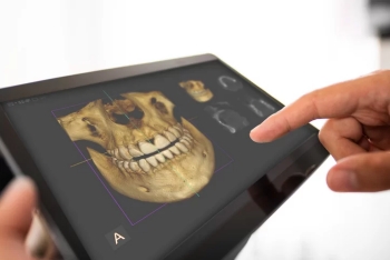 digital dental X-ray